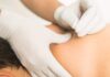how much does dry needling cost - edupain